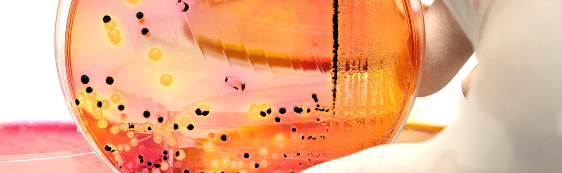 Challenge Test - ADRIA