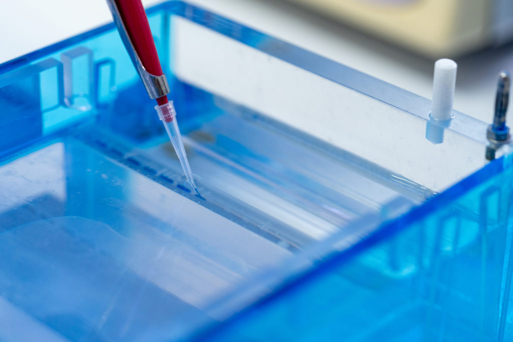 Molecular Technique Gel Electrophoresis For Dna Sample Method Decrypt The Genetic Code. Biochemistry And Clinical Chemistry In Laboratory.