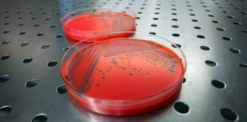 Boite De Petri Listeria Rapidl.mono Milieu Labo Microbiologie Copyright Adria