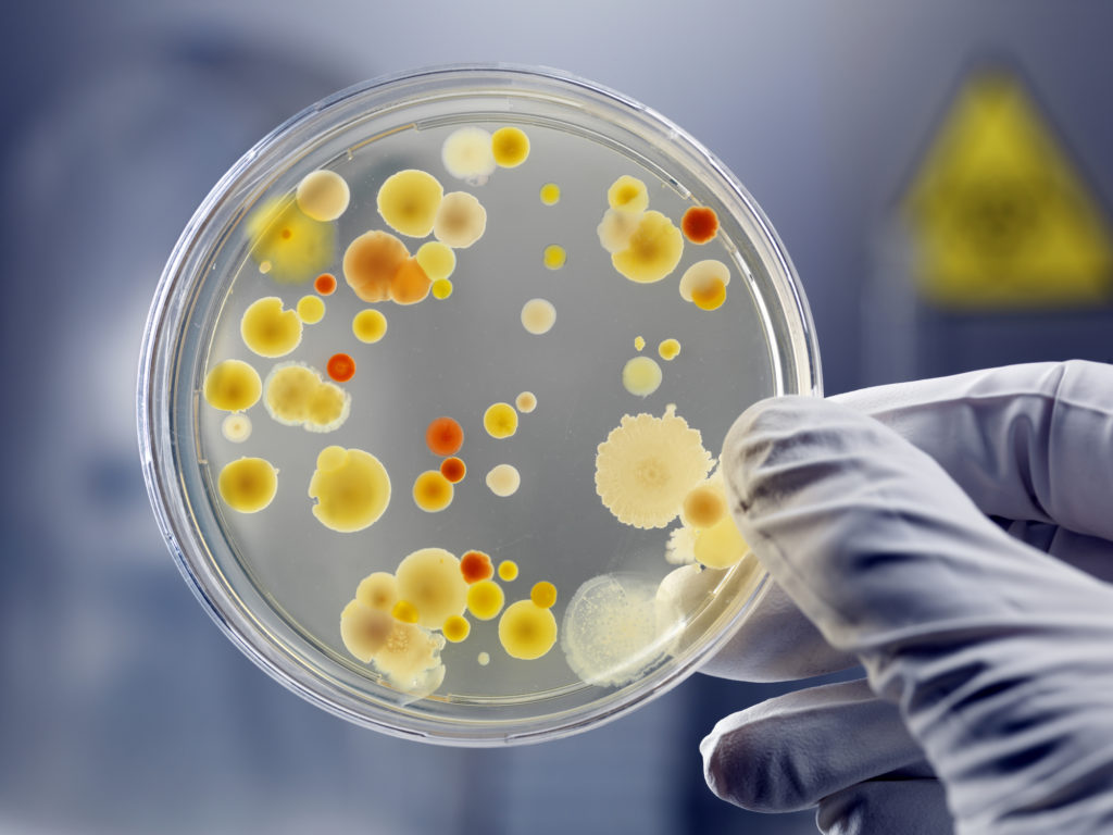 Gloved Hand Holding Petri Dish With Bacteria Culture