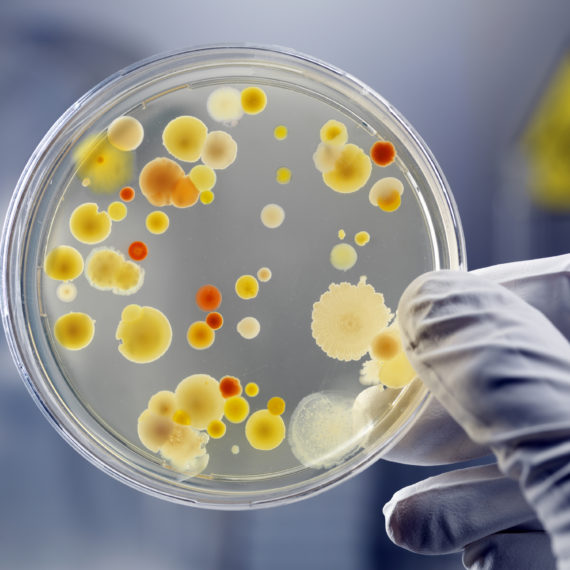 Gloved Hand Holding Petri Dish With Bacteria Culture