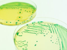 [ewen larreur] duo boite de petri, fond blanc, compass list et cci, labo, microbiologie