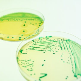 [ewen larreur] duo boite de petri, fond blanc, compass list et cci, labo, microbiologie