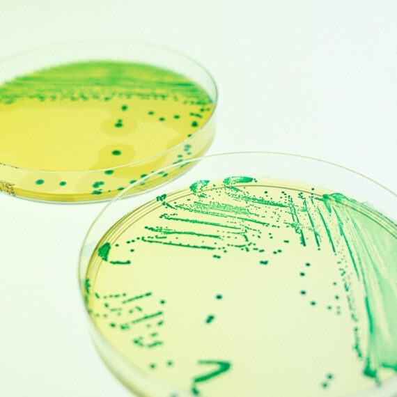 [ewen larreur] duo boite de petri, fond blanc, compass list et cci, labo, microbiologie